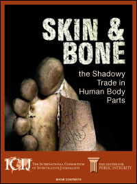 Skin & Bone